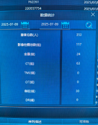 加上不变的坐式拍摄和去活动伪影的算法、仿活